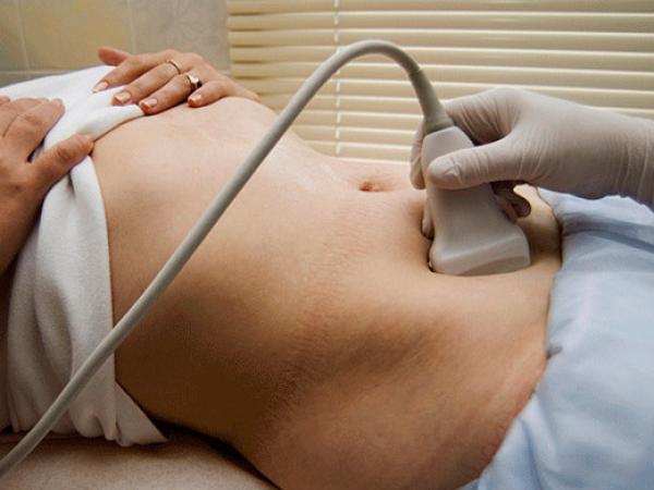 چرا تخمک گذاری به طور منظم رخ نمی دهد: دلایل اصلی